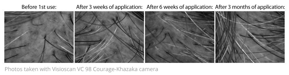 ديرمينا علاج تساقط وانبات الشعر كورس 2 باكيج امبول