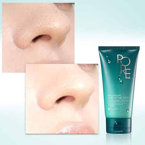 Pore & Oily skin Treatment (Offer )