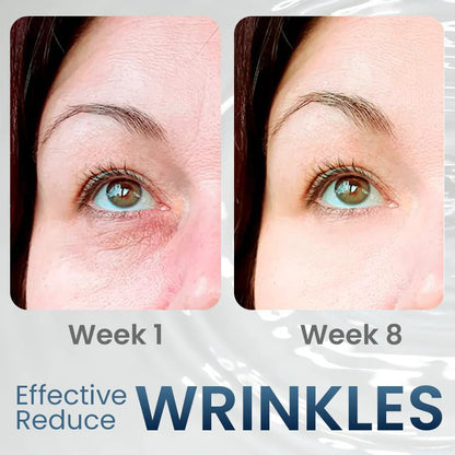 ميزون كريم كولاجين لشد وامتلاء وتفتيح حول العين 25 مل
